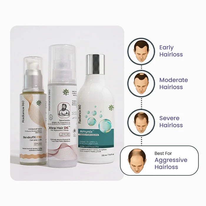 Three hair care products with images of men at different stages of hair loss on a white background.