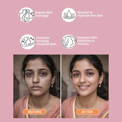 ANTI-ACNE ULTIMATE COMBO (V)