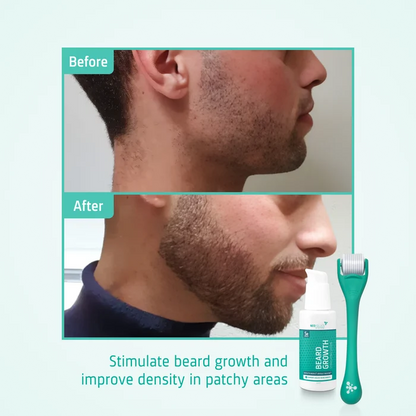 Beard Growth kit before after