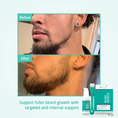 Beard Growth routine before after