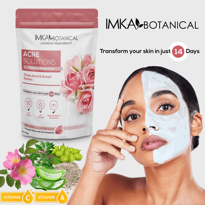 Herbal Face Mask to Get Rid of Acne & Pimples 50 gr - ShanShar Beauty : The world of beauty.
