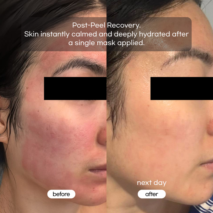 re'mirae Exo Collagen Masks (Box of 5)